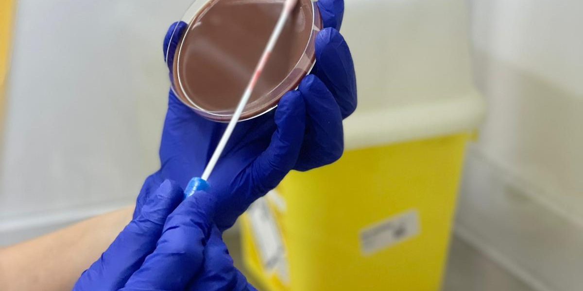 Zenit-cultivo-agar-xocolate