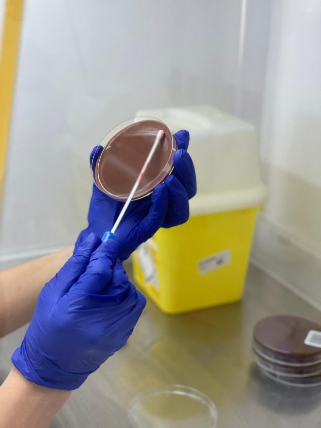 Zenit-cultivo-agar-xocolate