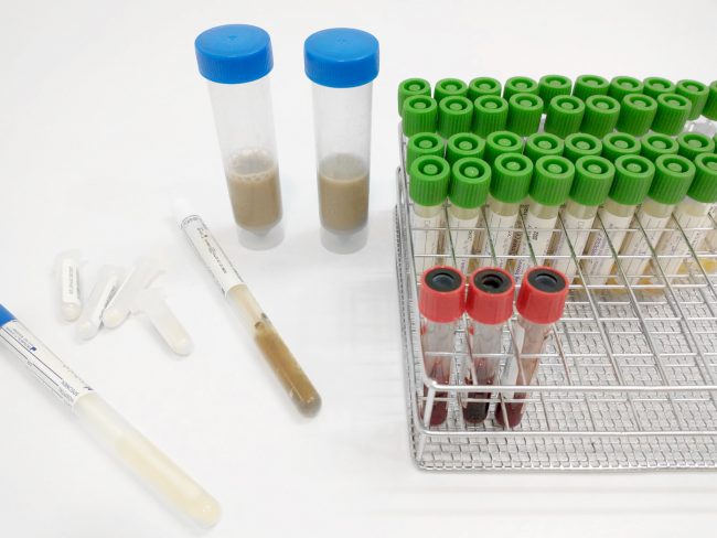 Zenit-muestras-hisopos