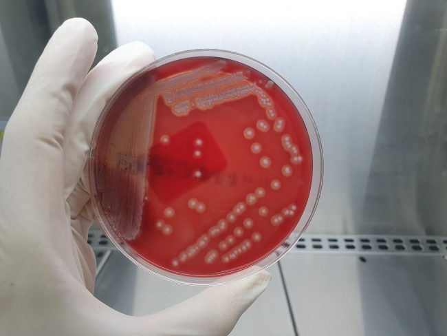 Escherichia coli beta hemolítico 2